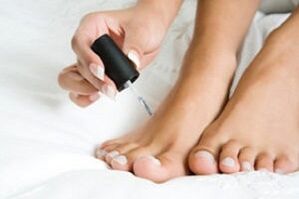 vernis voor de behandeling van schimmel op de voeten